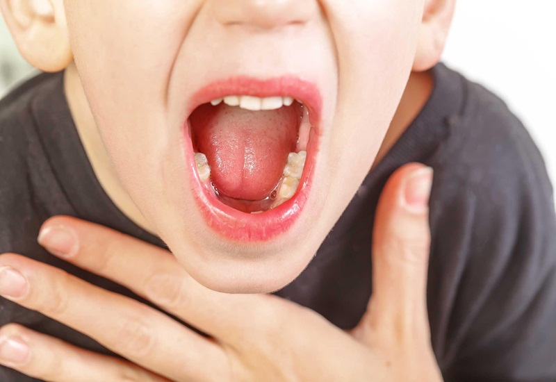 Nổi hột ở lưỡi là bệnh gì