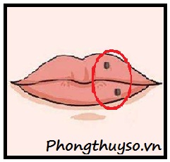 Nốt ruồi ở phong đương nữ