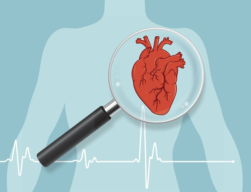 Thiếu máu cơ tim cục bộ là gì