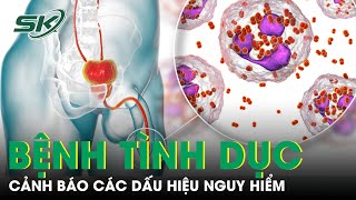 Tình dục không an toàn là gì