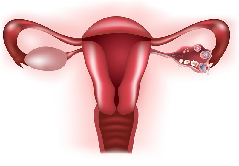 Vòi tử cung là gì